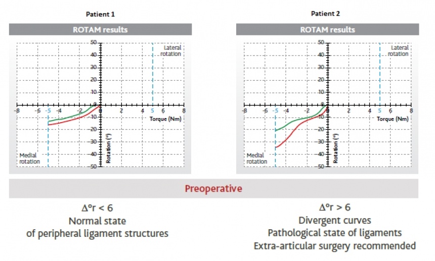 Graph Results of two patients