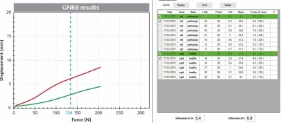 Graph 1 with its tables chart